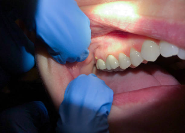 Best Emergency Cosmetic Dentistry (e.g., broken veneers) in Welcome, NC