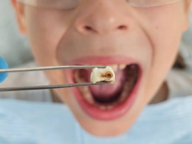 Best Emergency Pediatric Dental Care in Welcome, NC