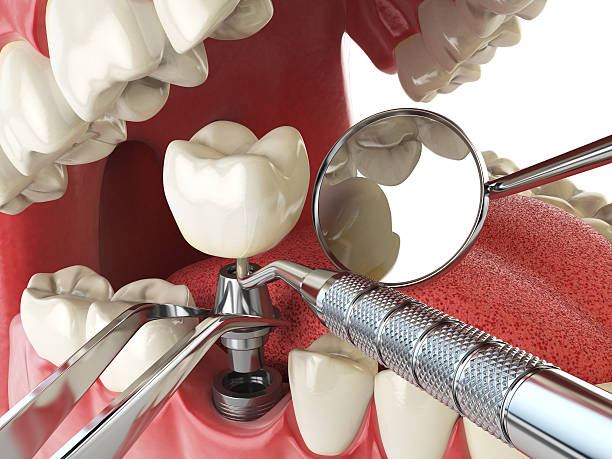 Best Walk-In Emergency Dental Services in Welcome, NC